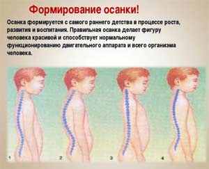 Консультация для родителей на тему: «ФОРМИРОВАНИЕ ОСАНКИ У ДЕТЕЙ ДОШКОЛЬНОГО ВОЗРАСТА»